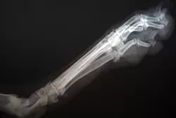 Arthrose beim Hund