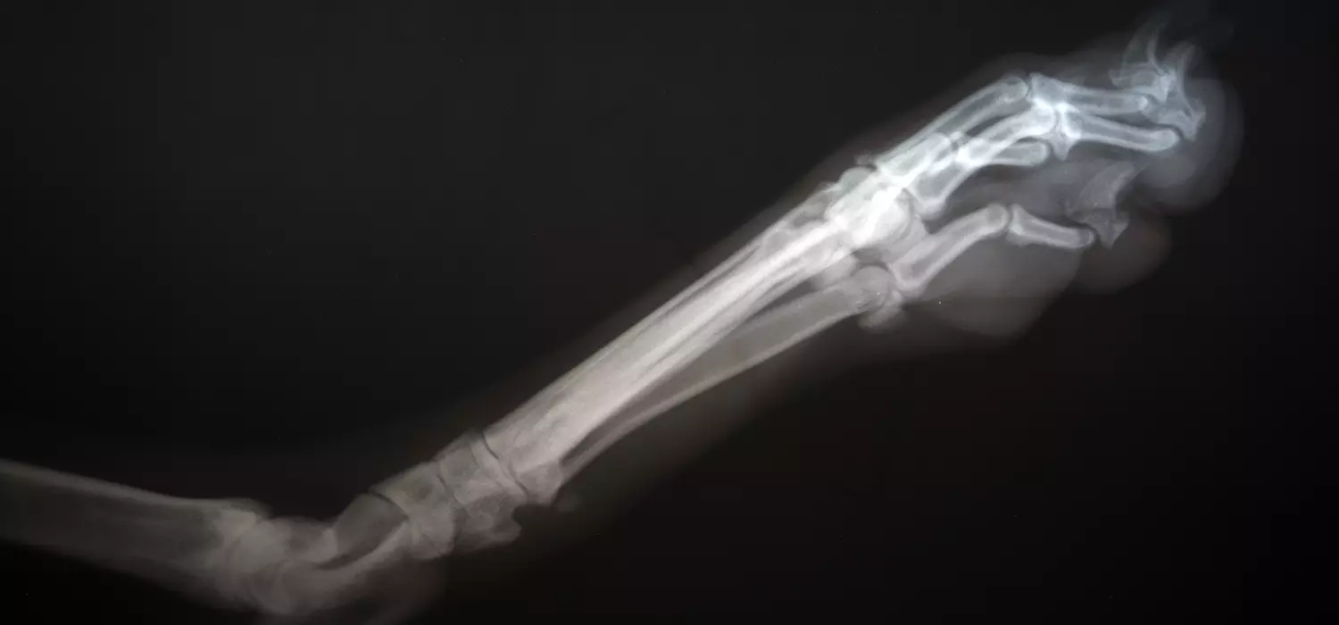 Arthrose beim Hund